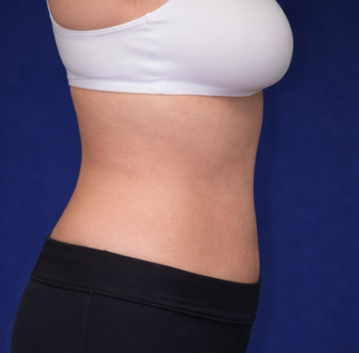 Before/After Image